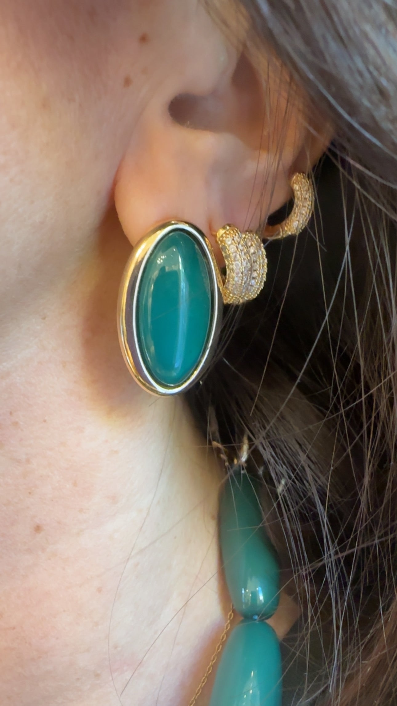 Bottone Verdone di MYA